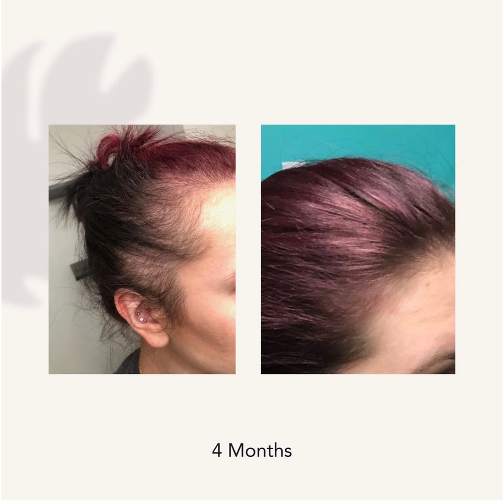 REGROWTH THICKENING SHAMPOO TREATMENT FOR WOMEN